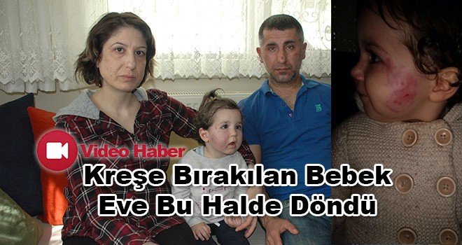 1,5 Yaşındaki Bebeğin Kreşte Darp Edildiği İddiası